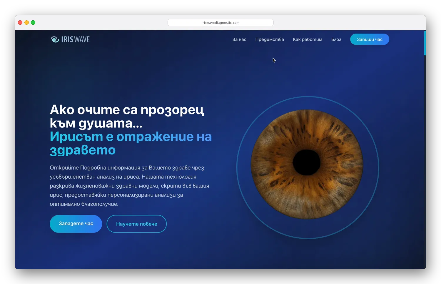 IrisWave Diagnostic